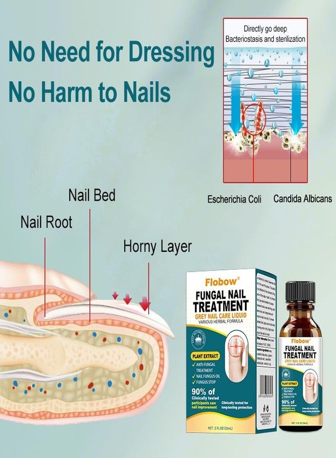 Flobow Toenail Fungus Treatment Extra Strength nail fungus treatment for fingernails, Yellow, Discolored, Broken and Ingrown Nails, ingrown nails and foot fungus treatment extra strength（30ML） - Image 5